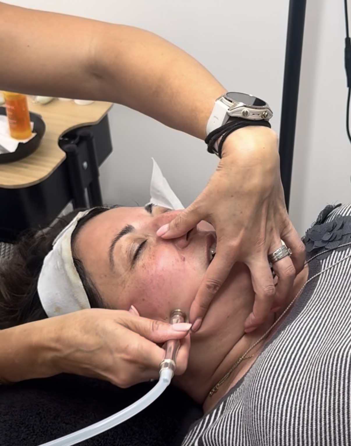 Microdermabrasion treatment